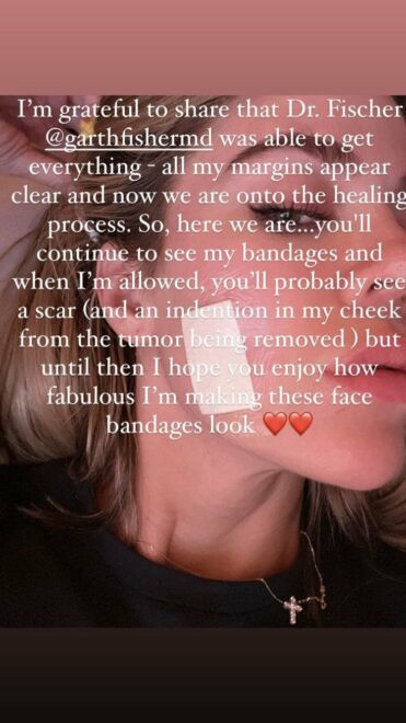 Ekran yıldızının kanser kabusu 'Yüzümden tümör aldırdım' dedi hastalığa dikkat çekti! - Resim: 1
