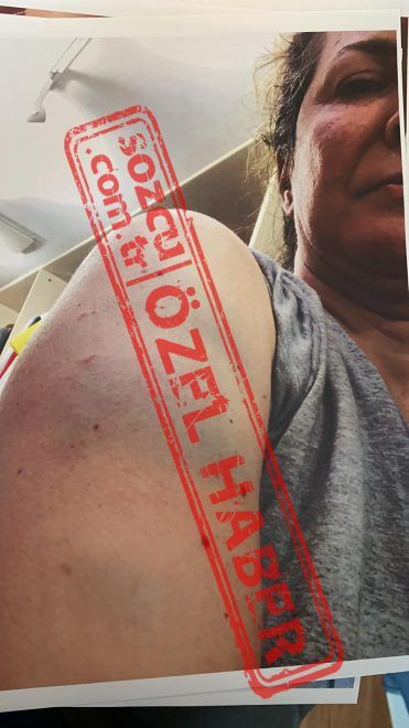 Tansu Çiller'in oğlu Mert Çiller eşinin kafasını duvardan duvara vurdu fuhuş detayı bomba - Resim: 4