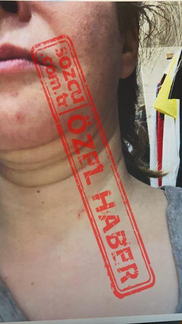 Mert Çiller eşini dövdü Tansu Çiller gelinini evden attırdı! Dava açıldı Mert Çiller'e 10 yıl hapis - Resim: 4