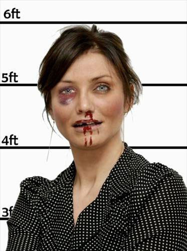 Ünlüler dayak yerse - Resim: 2