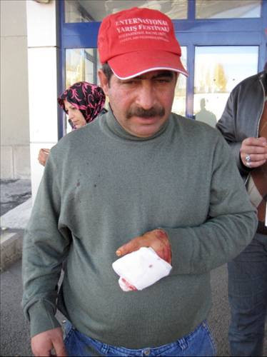 Acemi kasaplar kendini kesti! - Resim: 1