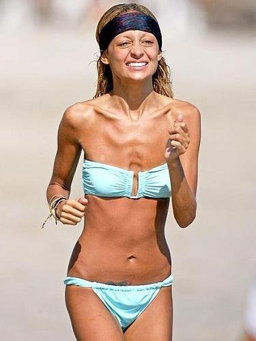 Bu hali şoke etti! Bu nasıl zayıflık - Resim: 2