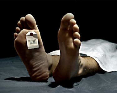 Türkler'i bu hastalıklar öldürdü - Resim: 4