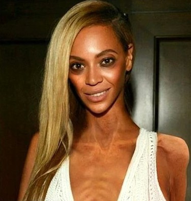 Zayıflıktan kemikleri sayılıyor Beyonce'a ne oldu böyle! - Resim: 3