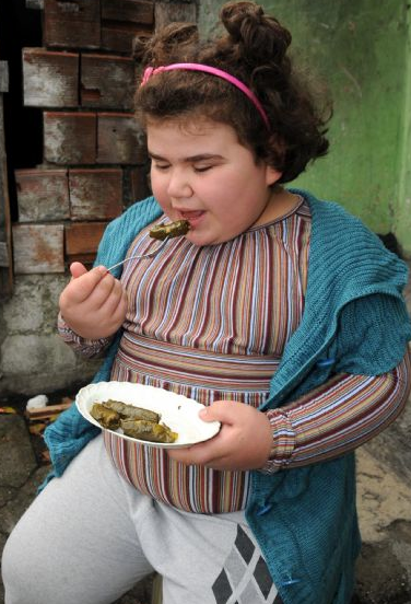 11 yaşında 84,5 kiloya ulaştı - Resim: 1