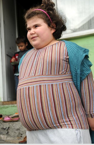 11 yaşında 84,5 kiloya ulaştı - Resim: 2