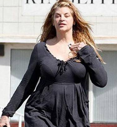 Ünlülerin defolu halleri - Resim: 2