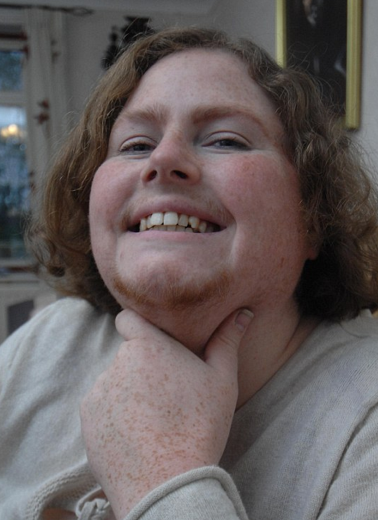 Sakallı kadın görenleri dehşete düşürdü - Resim: 4