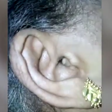 Kulaklarından öyle şeyler çıktı ki görenler hayret etti - Resim: 1