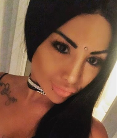 Göz  rengini değiştirmek isterken kör oldu - Resim: 1