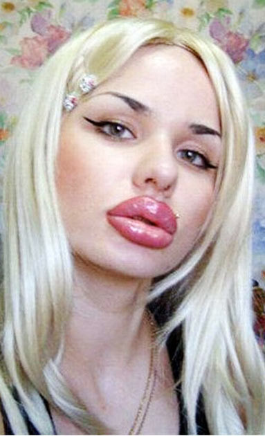 100 operasyonla bu hale geldi - Resim: 2