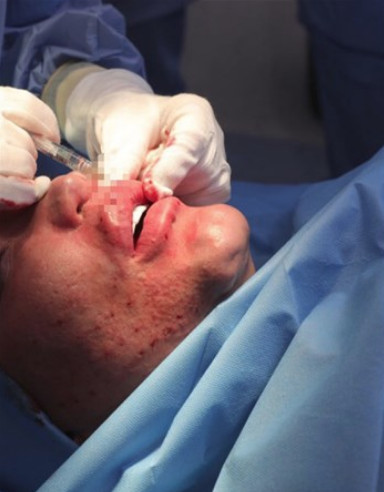 60 kez operasyon geçirdi doktorları dinlemedi! Son hali olay - Resim: 4