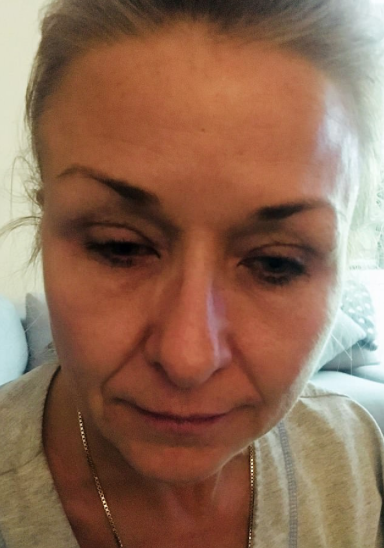 Tam 25 yıl boyunca gözündeki maskarasını temizlemedi bu görüntüler korkunç! - Resim: 2