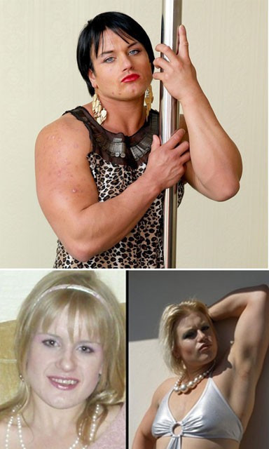 Steroidlerin kötüye kullanımı bakın insana neler yapıyor - Resim: 1