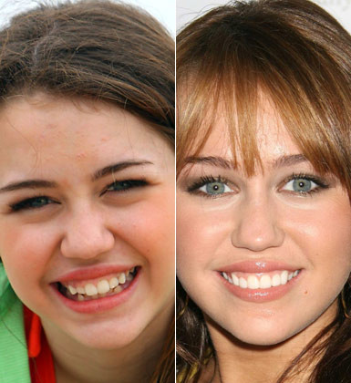 Gülümsemeleri de değişti - Resim: 3