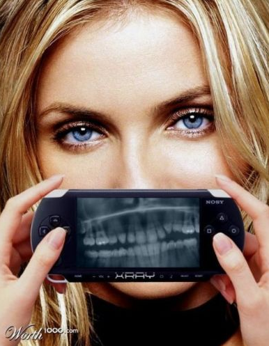 İnanılmaz Xray görüntüleri - Resim: 3