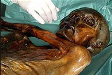 Dünyanın en eski cinayeti! - Resim: 2