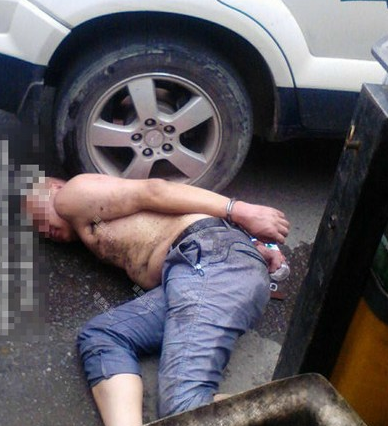 Yamyam kadının yüzünü yedi - Resim: 4