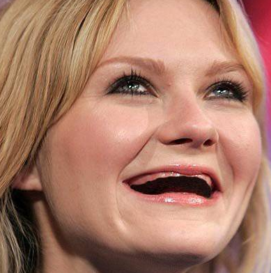 Hollywood güzellerinin dişsiz halleri! - Resim: 2