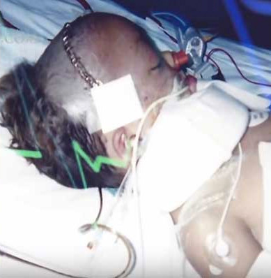 Baba oğul kazada öldü oğul dirildi ve öyle bir şey söyledi ki... - Resim: 4