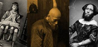 Bu kadının dört bacağı var - Resim: 1