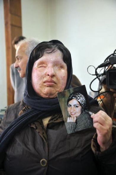 Kezzaplı intikamdan vazgeçti - Resim: 2