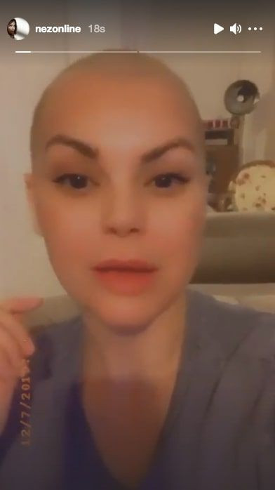 Nez yeni imajıyla görenleri hayrete düşürdü herkes hasta olduğunu sandı - Resim: 4