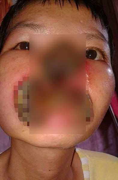 Ülkenin en güzel oyuncusunun geldiği hale bakın korkunç! - Resim: 2