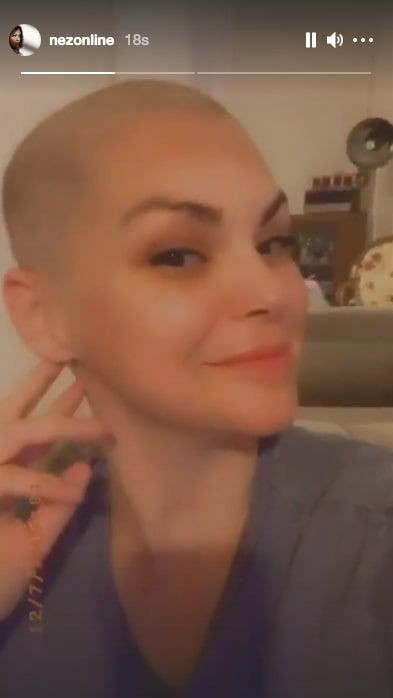 Nez yeni imajıyla görenleri hayrete düşürdü herkes hasta olduğunu sandı - Resim: 2