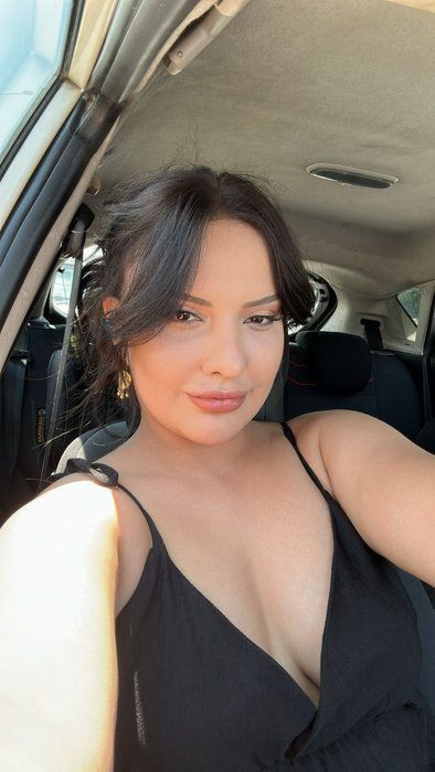 'Badem Göz' olmak için estetik masasına yattı sona faciayla bitti! Eski halinden eser yok şimdi - Resim: 2