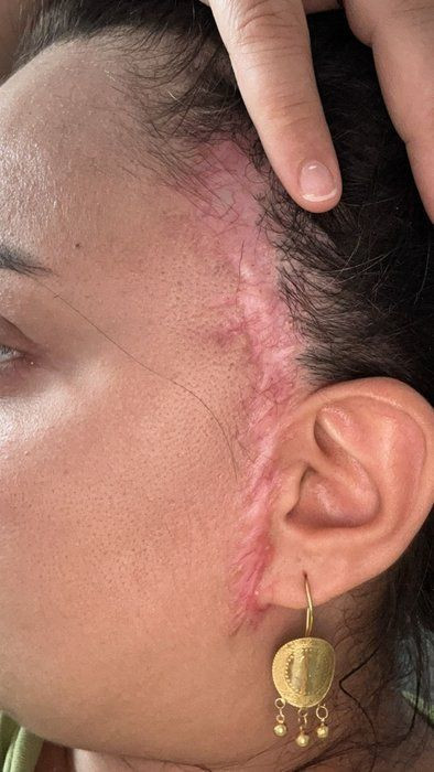 'Badem Göz' olmak için estetik masasına yattı sona faciayla bitti! Eski halinden eser yok şimdi - Resim: 3