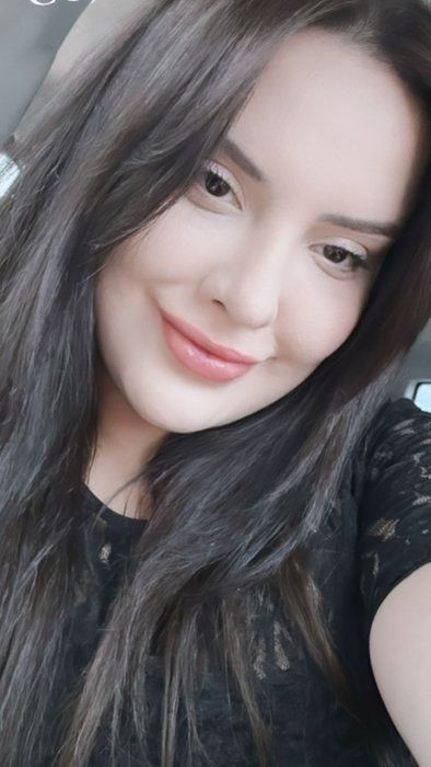 'Badem Göz' olmak için estetik masasına yattı sona faciayla bitti! Eski halinden eser yok şimdi - Resim: 1