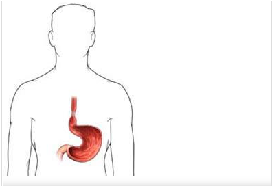 Bu hastalık başınıza dert olmasın - Resim: 3