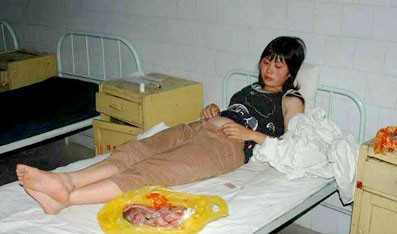 Çin'den olay kürtaj fotoğrafları - Resim: 2