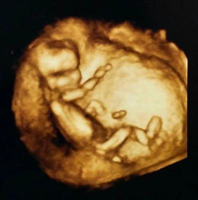 Bebeğin yanında bir de kedi bekliyorlar - Resim: 2