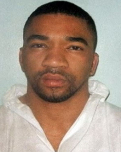 Yüzü böyleydi bu hale geldi - Resim: 4