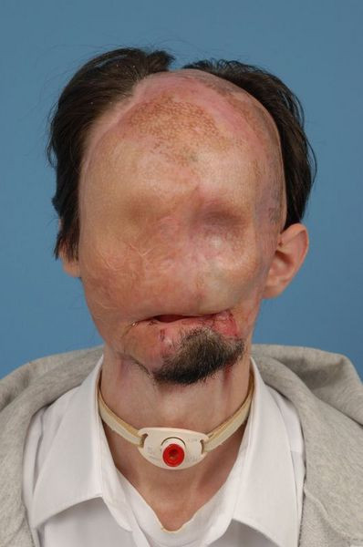 Nakilden bir yıl sonra ilk öpücük - Resim: 4