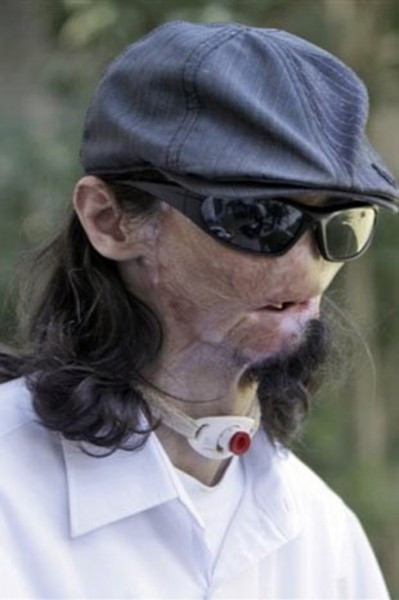 İşte baştan yaratılan o adam! - Resim: 4