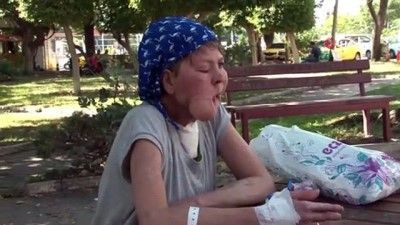 Antalya'da çenesinde çıkan sivilce hayatını kararttı! Meğer bakın neymiş - Resim: 4