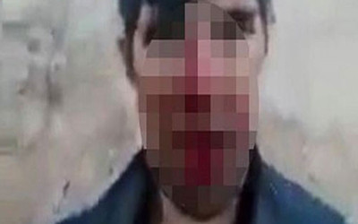 Taciz şüphelisini dövüp cep telefonuyla kameraya çektiler