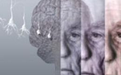 Alzheımer belirtileri ne zaman başlıyor?
