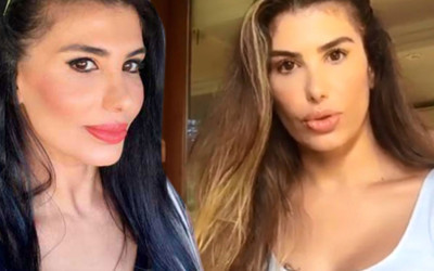Hatice'nin yüzü yandı