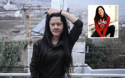 Asitle yüzü yakılan Berfin Özek'ten karar sonrası zor soru