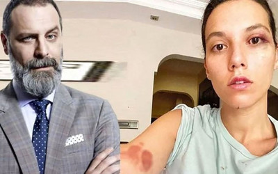 Deniz Bulutsuz'a şiddet iddiası Ozan Güven'in hayatını alt üst etti! Son hali şoke etti