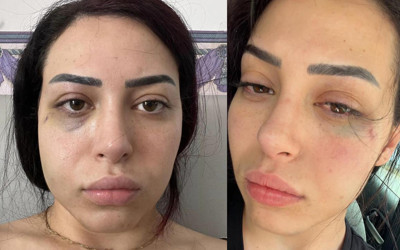 GKRY’de 25 yaşındaki Türk kızına saldıran 2 Rum tutuklandı