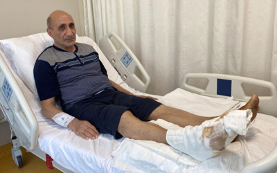 Leke sökücü yüzünden neredeyse ayağından oluyordu!