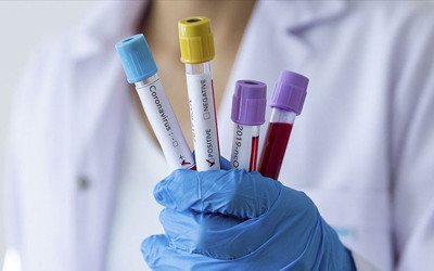 DSÖ Ebola salgınının risk düzeylerini açıkladı