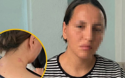 Mersin'de 3 çocuk annesi talihsiz kadın bıçakla yaralayan eşinin cezalandırılmasını istiyor...