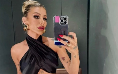 İrem Derici'den hayranlarını korkutan haber! Parmağı yamuldu