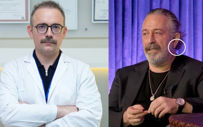 Kulak çizgisi gerçekten kalp krizi belirtisi mi? Cem Yılmaz'da görüldü doktor açıkladı